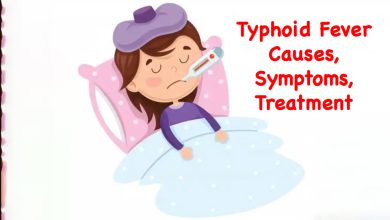 Typhoid fever causes, symptoms, treatment