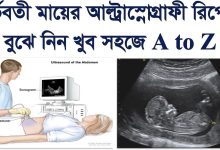 আল্ট্রাসনোগ্রাম রিপোর্ট ছেলে না মেয়ে বোঝার উপায় ২০২৫ (Ultrasonogram report: How to tell if it's a boy or a girl 2025)!