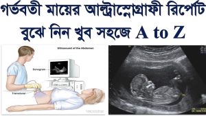 Read more about the article আল্ট্রাসনোগ্রাম রিপোর্ট ছেলে না মেয়ে বোঝার উপায় ২০২৫